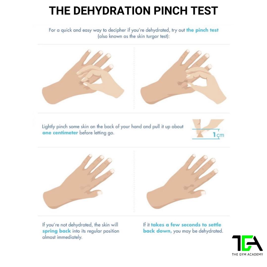 The pinch test is a quick way to test if you are dehydrated