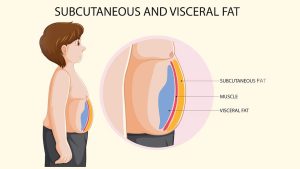 Visceral fat is the most dangerous for your health